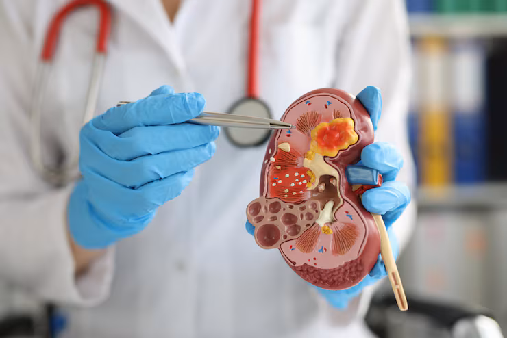 Nephrology